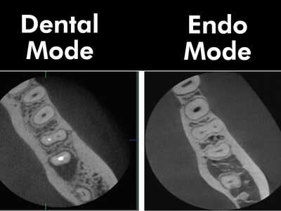 Vatech Smart X CBCT